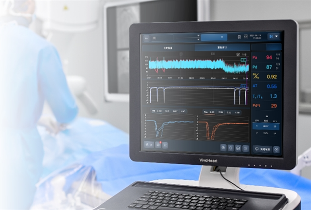 北芯生命推出新一代集成方案,赋能心血管精准介入诊疗